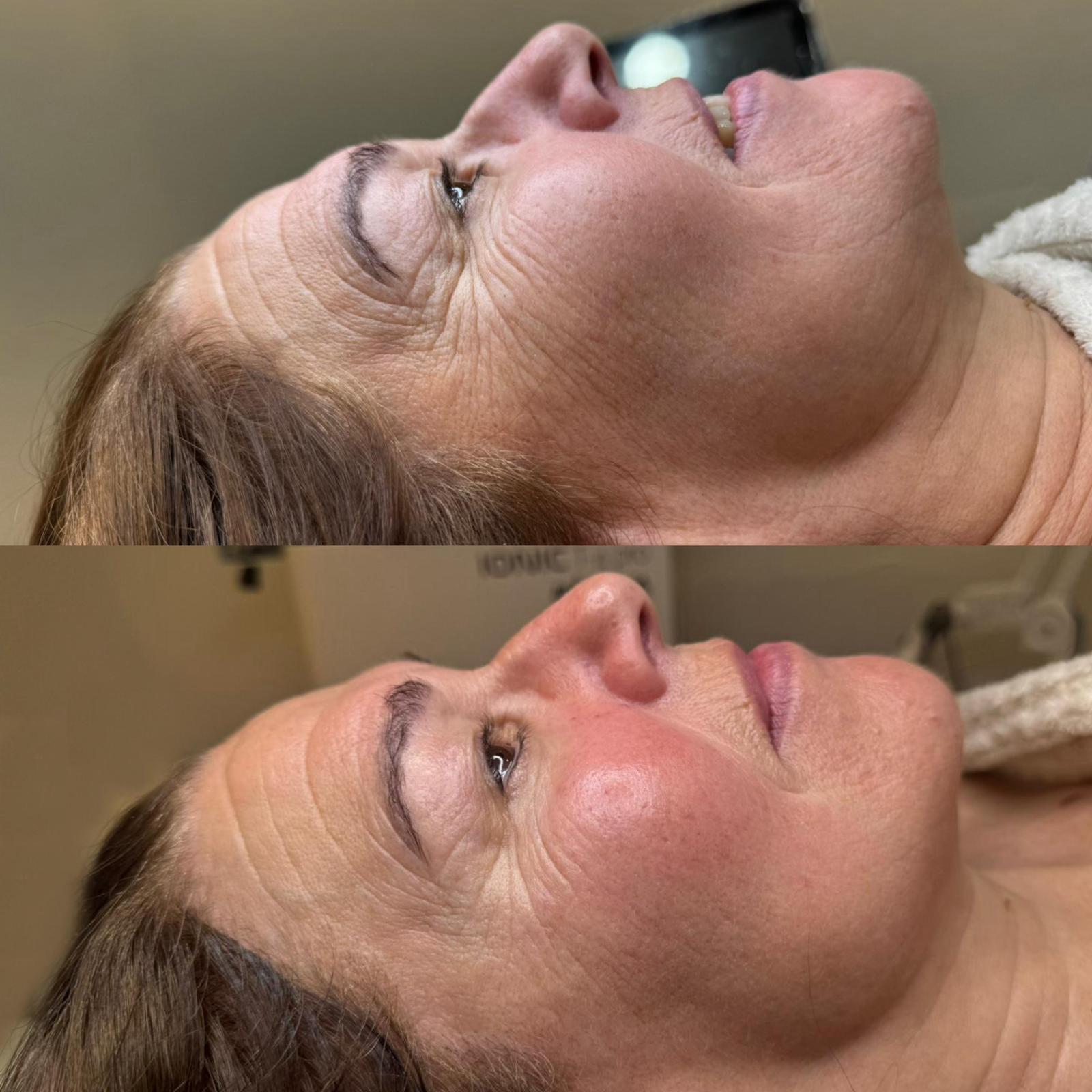 Tratamientos faciales y corporales